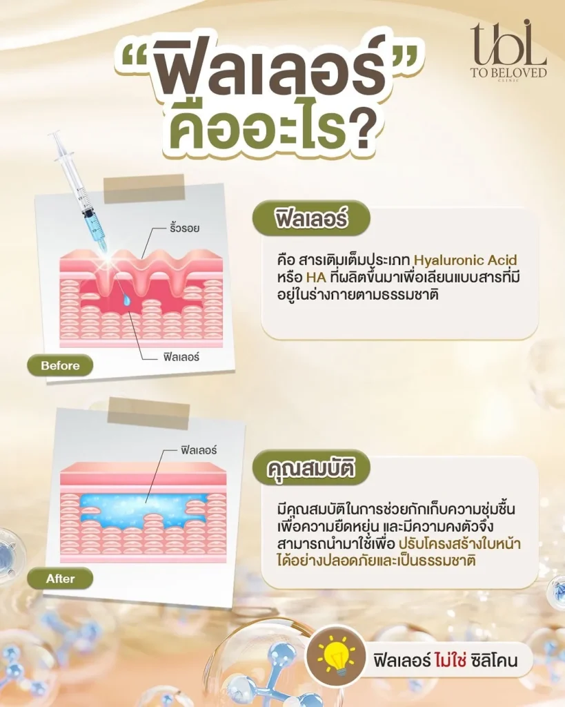 ฟิลเลอร์
